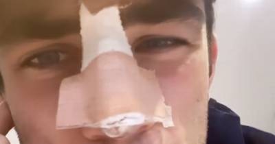 Jack Fincham says he's in 'blistering pain' as he unveils bandaged nose following emergency surgery - www.ok.co.uk