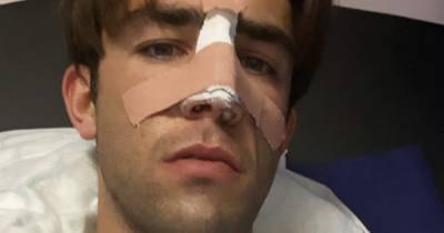 Jack Fincham unveils nose after having bandage removed from emergency surgery following car accident - www.ok.co.uk