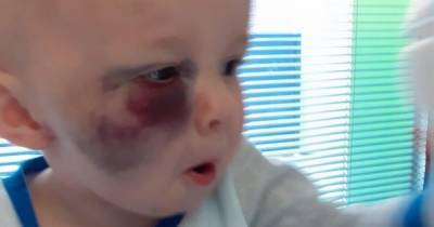 Scots tot who bruised if mum touched him has beaten blood disorder that left him black and blue - www.dailyrecord.co.uk - Scotland