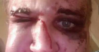 Scots mum left bloodied and bruised after being battered in unprovoked Glasgow street attack - www.dailyrecord.co.uk - Scotland