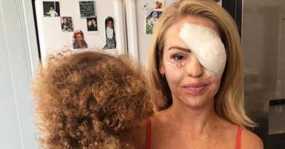 Katie Piper shares update after undergoing '400th operation' following 2008 acid attack – EXCLUSIVE - www.ok.co.uk