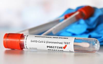 Get a coronavirus test before heading home for holiday, colleges say - www.foxnews.com