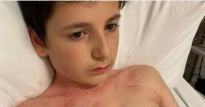Scots schoolboy diagnosed with bone marrow failure after bruising knee when he fell off his bike - www.dailyrecord.co.uk - Scotland