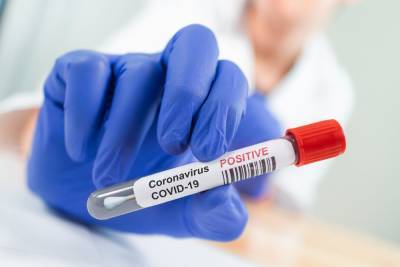 Drop in new coronavirus cases in some Midwestern states offers signs of hope - www.foxnews.com - California