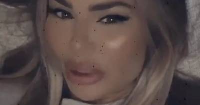Chloe Sims furiously slams trolls who claim star has had 'too much surgery' and 'can't move her face' - www.ok.co.uk
