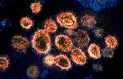 UK coronavirus variant found in Southern California - www.foxnews.com - Britain - California - Colorado