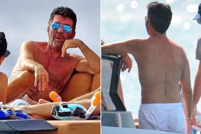 Simon Cowell reveals large scar from back surgery - nypost.com - Barbados