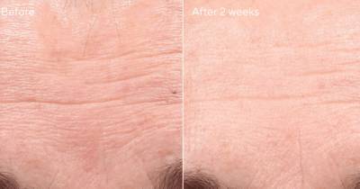 This Anti-Aging Serum Is Producing Amazing Results After Just 2 Weeks - www.usmagazine.com