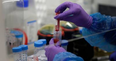'Major breakthrough' as drug trial finds steroid can reduce coronavirus deaths - www.manchestereveningnews.co.uk
