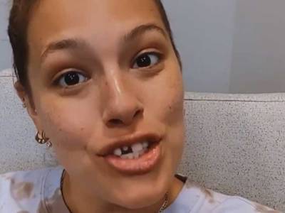 Ashley Graham shows off broken tooth in funny video - canoe.com