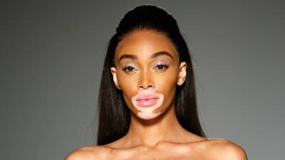 Winnie Harlow Apologizes to Woman Accusing Her of Being a 'Mean Girl,' Then Says She's Lying for Clout - www.justjared.com