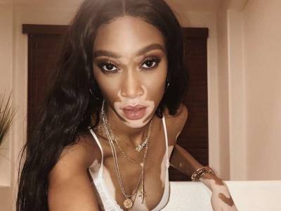 Winnie Harlow Accused Of Being A ‘Mean Girl’ On Twitter After Bumping Into A Woman At A Bar - celebrityinsider.org - Los Angeles