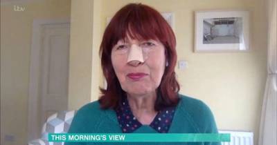 Janet Street-Porter wears bandage on her nose after getting skin cancer growth removed - www.ok.co.uk