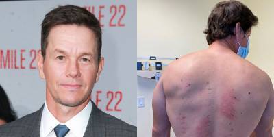Mark Wahlberg Just Found Out He's 'Allergic to Almost Everything' - www.justjared.com