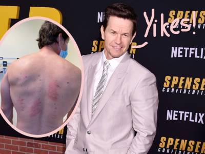 Mark Wahlberg Says He’s ‘Allergic To Almost Everything’!! - perezhilton.com