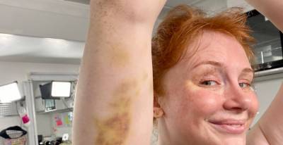 Bryce Dallas Howard Shows Off Her Massive Bruises from 'Jurassic World' Set - www.justjared.com - county Howard - county Dallas