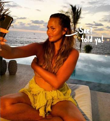 Chrissy Teigen Shares NSFW Picture Proof Of Her Breast Implant Removal Surgery! - perezhilton.com