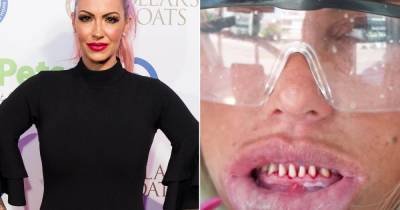 Jodie Marsh reignites Katie Price feud by taking swipe at her natural teeth - www.ok.co.uk - Turkey