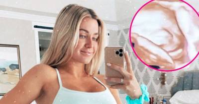 Pregnant Lindsay Arnold Shows ‘Flexible’ Daughter’s Ultrasound: Her Foot Is ‘on Her Head’ - www.usmagazine.com - Utah