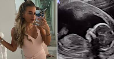 Pregnant Dani Dyer shares amazingly clear ultrasound snap of unborn baby and says it 'makes her day' - www.ok.co.uk