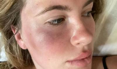 Ireland Baldwin Was Attacked & Robbed by Woman Who Was 'High Out of Her Mind' - www.justjared.com - Ireland