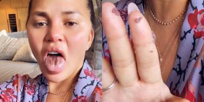 Chrissy Teigen Says Her 'Tongue Is Falling Off' from Eating 'So Much' Sour Candy - www.justjared.com