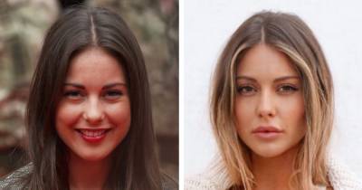 Louise Thompson’s changing face: Experts advise on what procedures she's had done - www.ok.co.uk - Chelsea