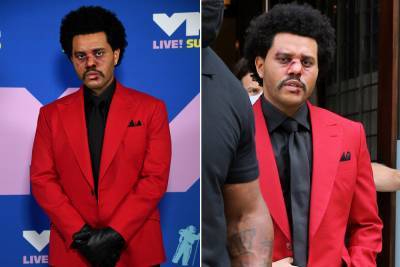 What happened to The Weeknd’s face? Why he was bloody at the VMAs - nypost.com - New York