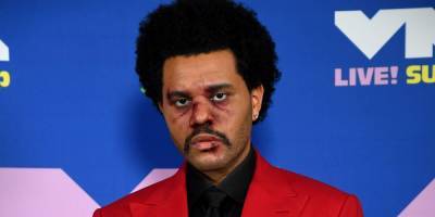 Um, Why Is the Weeknd's Face Bloodied at the VMAs? - www.marieclaire.com