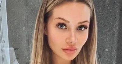 Love Island star Shaughna Phillips undergoes mystery surgery as she shows off bandaged legs - www.ok.co.uk
