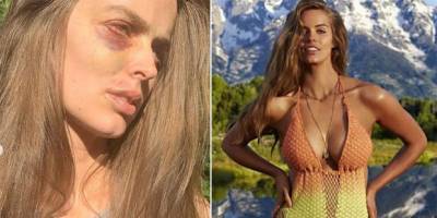 Aussie model, Robyn Lawley, shares the harsh reality of her chronic illness - www.lifestyle.com.au