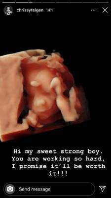 Pregnant Chrissy Teigen shares ultrasound of her ‘sweet, strong boy’ - www.breakingnews.ie