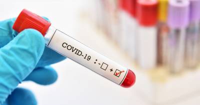 New 'game changing' swab test can detect coronavirus in less than 20 minutes - www.dailyrecord.co.uk - Britain - city Cambridge