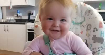 Scots mum trying to raise money to fix baby’s skull deformity before it’s too late - www.dailyrecord.co.uk - Scotland