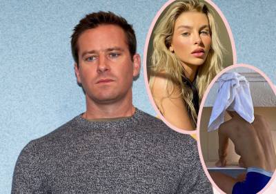 ANOTHER Armie Hammer Ex Comes Forward, Claims He Carved An 'A' Into Her With A Knife! - perezhilton.com