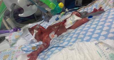 'Such a battler': The miracle baby born after his mum thought she was having a miscarriage - www.manchestereveningnews.co.uk