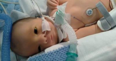 The baby boy with a rare condition which means his parents will never see him smile - www.manchestereveningnews.co.uk