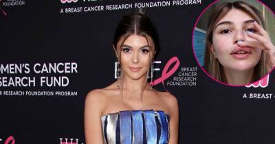 Olivia Jade Giannulli Shows Off Scars as She Recalls ‘Crazy’ Fainting Incident That Injured Her Lip, Head and Nose - www.usmagazine.com