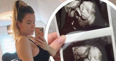 TOWIE's Georgia Kousoulou shares sweet baby scan picture - www.msn.com