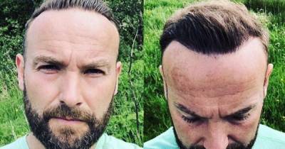 'It needs to be less of a stigma': Liberty X singer Kevin Simm's hair transplant - www.manchestereveningnews.co.uk - Britain