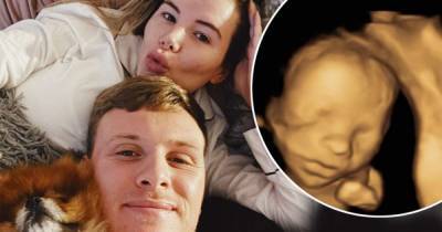 Georgia Kousoulou and Tommy Mallet share 4D scan picture of their baby - www.msn.com