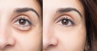 This New Eye Treatment From REN Skincare Instantly Reduces Puffiness - www.usmagazine.com