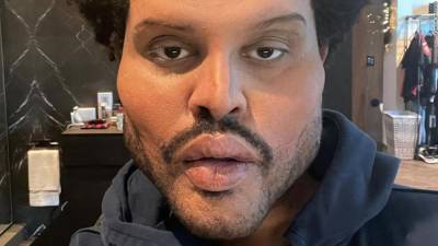 The Weeknd's face freaks some people out - edition.cnn.com