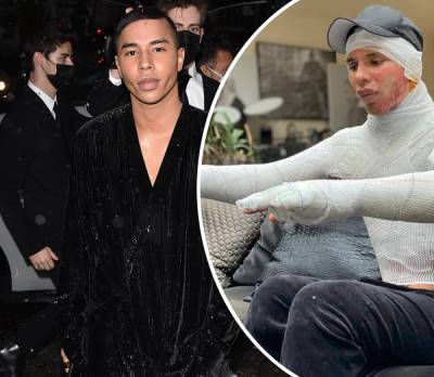 Balmain Designer Olivier Rousteing Reveals He Was Severely Burned Last Year After A Fireplace Explosion - perezhilton.com
