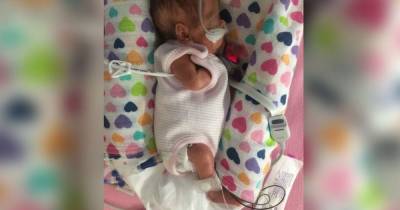 Miracle baby girl born three months early weighed just 650g and was the size of a 'biro' pen - www.manchestereveningnews.co.uk