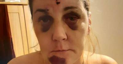 Terrified mourner 'beaten black and blue by five people' at her friend's wake - www.dailyrecord.co.uk - Birmingham