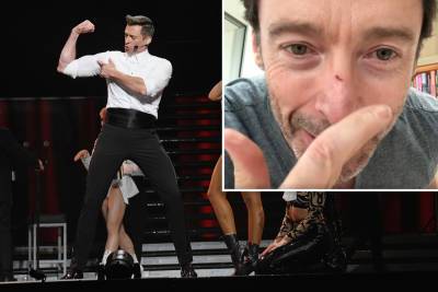 Hugh Jackman slices nose in freak mishap during ‘Music Man’ rehearsal - nypost.com