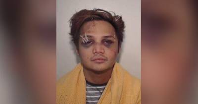 Battered and bruised... the first look at serial rapist Reynhard Sinaga’s mugshot following arrest - www.manchestereveningnews.co.uk