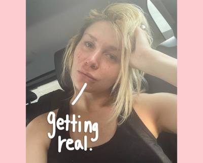 Courtney Stodden Shows Face Full Of ‘Hormonal Acne’ In Raw Post About Realities Of Anxiety - perezhilton.com
