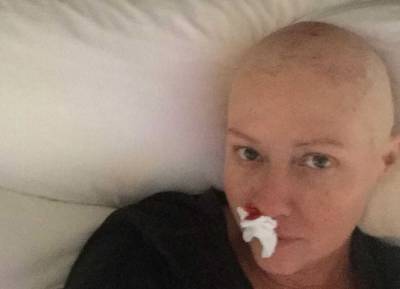 ‘Is it pretty? NO’ Shannen Doherty shares ‘truthful’ chemo picture - evoke.ie